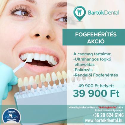 Fogfehérítés AKCIÓ Fogfehérítés AKCIÓ