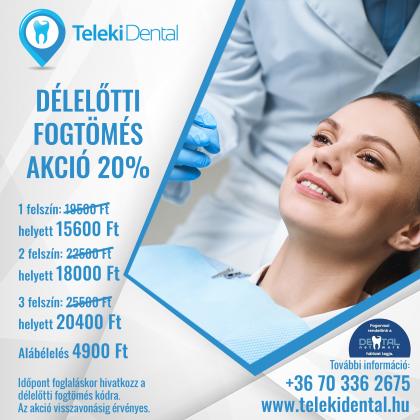 Délelőtti Fogtömés AKCIÓ Délelőtti Fogtömés AKCIÓ
