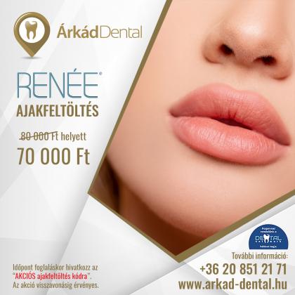 RENÉE Ajak feltöltés AKCIÓ RENÉE Ajak feltöltés AKCIÓ