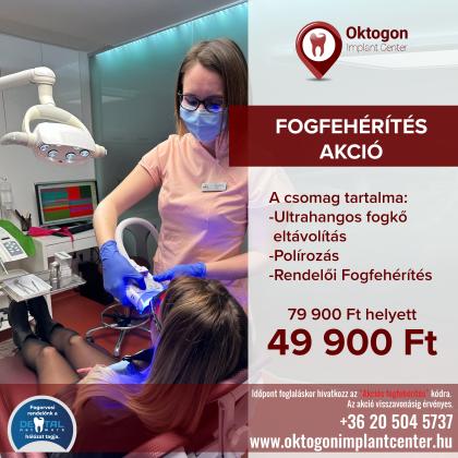 Fogfehérítés AKCIÓ Fogfehérítés AKCIÓ