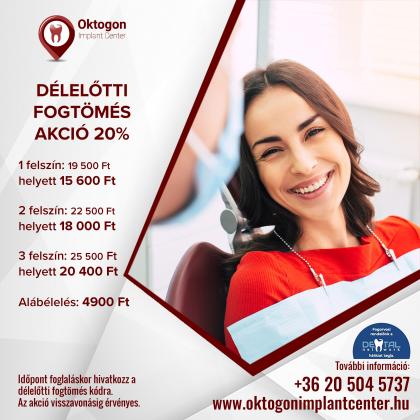 Délelőtti Fogtömés AKCIÓ Délelőtti Fogtömés AKCIÓ