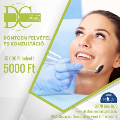 Röntgen felvétel és konzultáció Röntgen felvétel és konzultáció