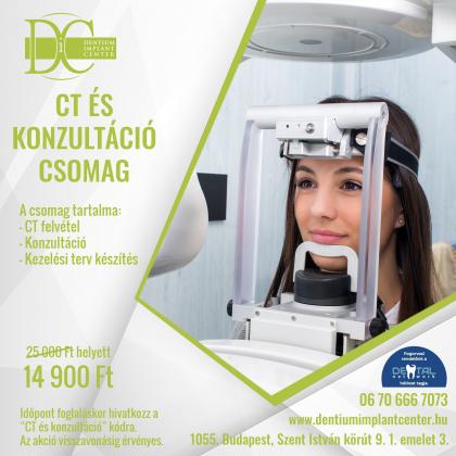 CT felvétel és konzultáció csomag CT felvétel és konzultáció csomag