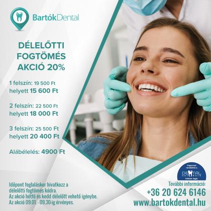 Délelőtti Fogtömés AKCIÓ Délelőtti Fogtömés AKCIÓ
