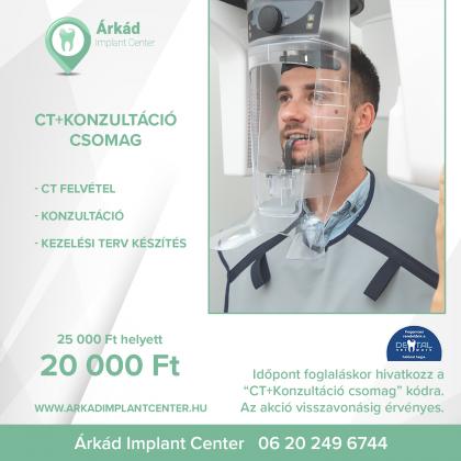 CT felvétel és ingyen konzultáció CT felvétel és ingyen konzultáció