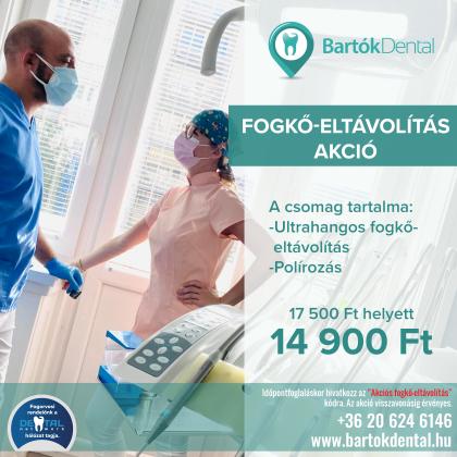 Fogkő Eltávolítás Akció Fogkő Eltávolítás Akció