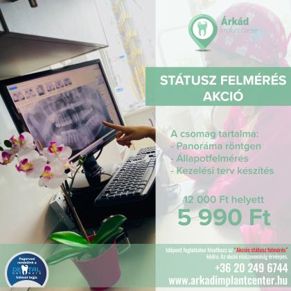 Státusz Felmérés AKCIÓ