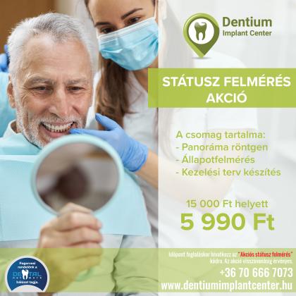 Státusz Felmérés AKCIÓ