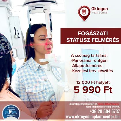 Státusz Felmérés AKCIÓ