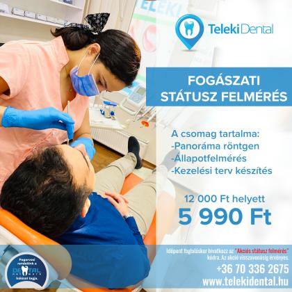 Státusz Felmérés AKCIÓ