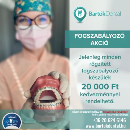Fogszabályozás AKCIÓ
