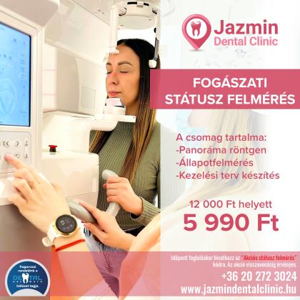 Státusz Felmérés AKCIÓ