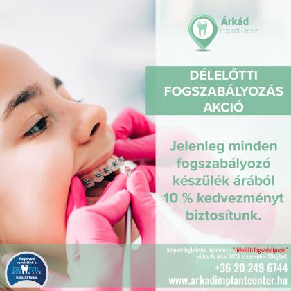 Délelőtti Fogszabályozás AKCIÓ Délelőtti Fogszabályozás AKCIÓ