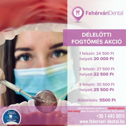 Délelőtti Fogtömés AKCIÓ Délelőtti Fogtömés AKCIÓ