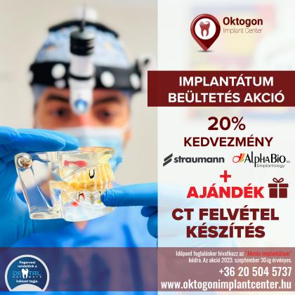 Fogászati implantátum beültetés AKCIÓ Fogászati implantátum beültetés AKCIÓ