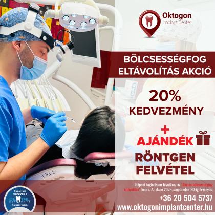Bölcsességfog eltávolítás AKCIÓ Bölcsességfog eltávolítás AKCIÓ