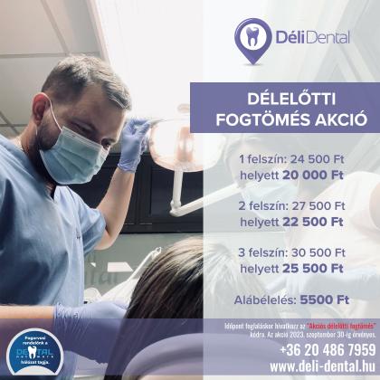 Délelőtti Fogtömés AKCIÓ Délelőtti Fogtömés AKCIÓ