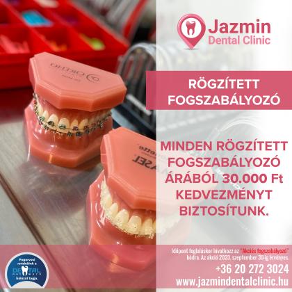 Fogszabályozás AKCIÓ Fogszabályozás AKCIÓ