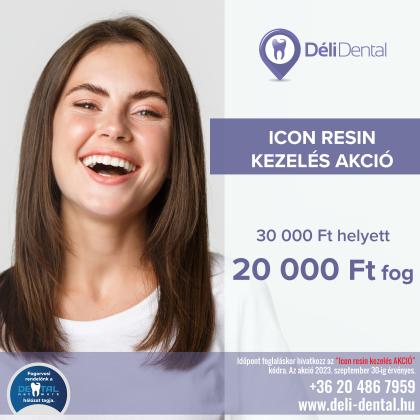 Icon resin kezelés AKCIÓ Icon resin kezelés AKCIÓ
