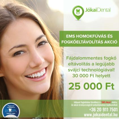 EMS homokfúvás és fogkőeltávolítás Akció EMS homokfúvás és fogkőeltávolítás Akció