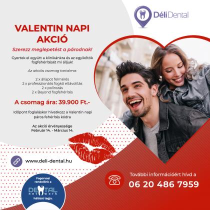 Valentin napi Akció! Valentin napi Akció!