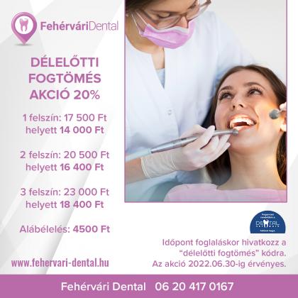 Délelőtti Fogtömés Akció! Délelőtti Fogtömés Akció!