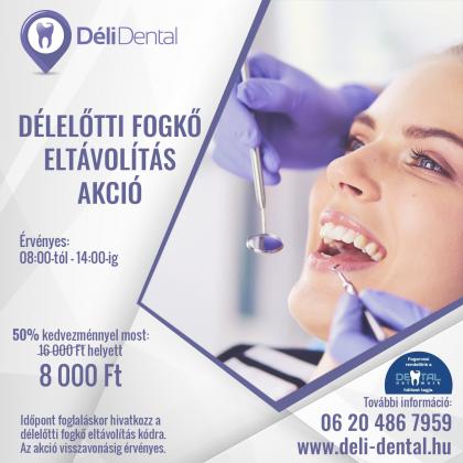 Délelőtti Fogkő Eltávolítás Akció! Délelőtti Fogkő Eltávolítás Akció!