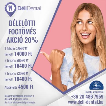 Délelőtti Tömés AKCIÓ Délelőtti Tömés AKCIÓ
