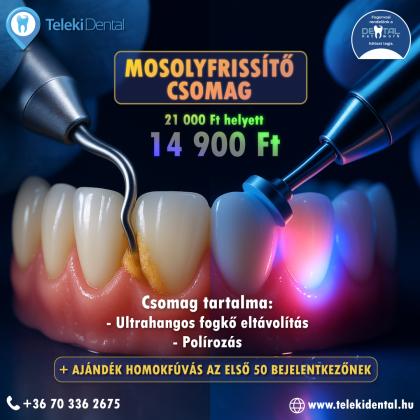 Mosolyfrissítő Akció