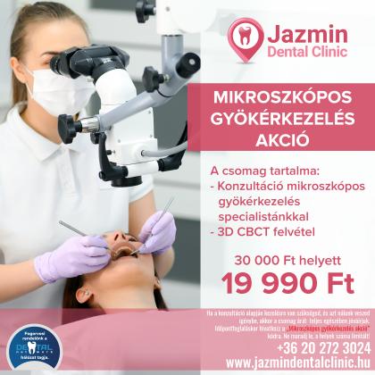 Mikroszkópos gyökérkezelés akció Mikroszkópos gyökérkezelés akció