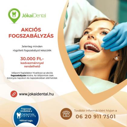 Akciós fogszabályzás Akciós fogszabályzás
