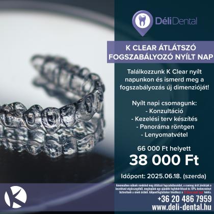 K Clear átlátszó fogszabályozó nyílt nap K Clear átlátszó fogszabályozó nyílt nap