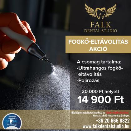 Fogkő Eltávolítás Akció