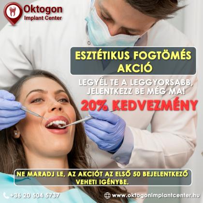 Esztétikus fogtömés akció