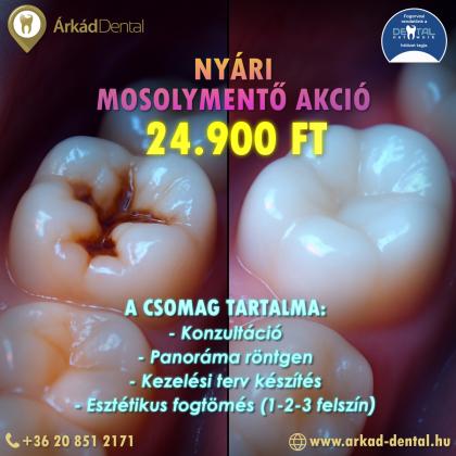 Nyári Mosolymentő Akció