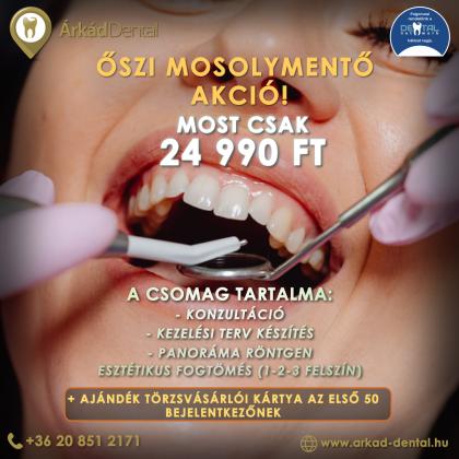 Őszi Mosolymentő Akció Őszi Mosolymentő Akció