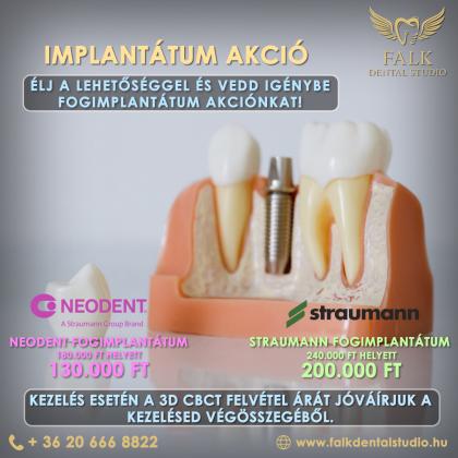 Implantátum akció