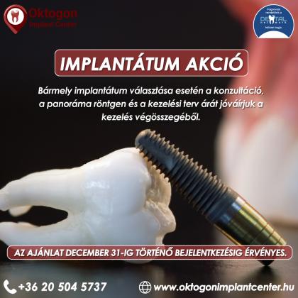Implantátum Akció Implantátum Akció