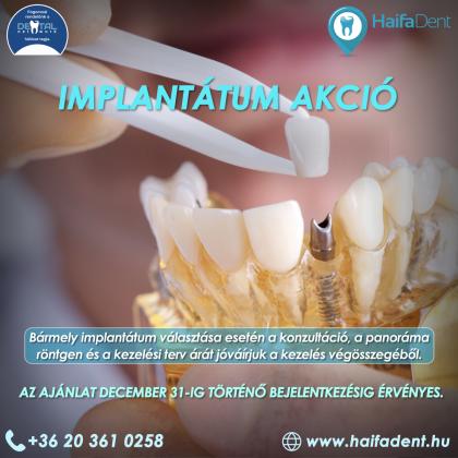 Implantátum Akció Implantátum Akció