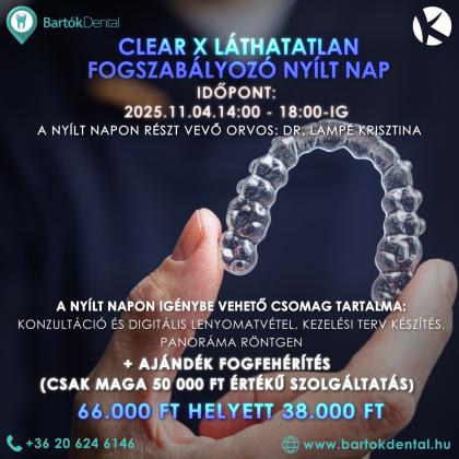 Clear X Nyílt Nap Clear X Nyílt Nap