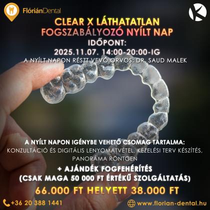 Clear X Nyílt Nap Clear X Nyílt Nap