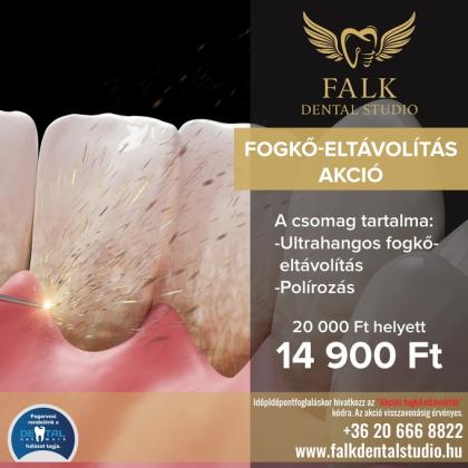 Fogkő Eltávolítás AKCIÓ Fogkő Eltávolítás AKCIÓ