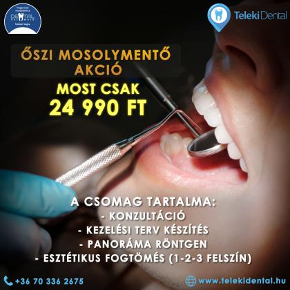 Őszi Mosolymentő Akció Őszi Mosolymentő Akció