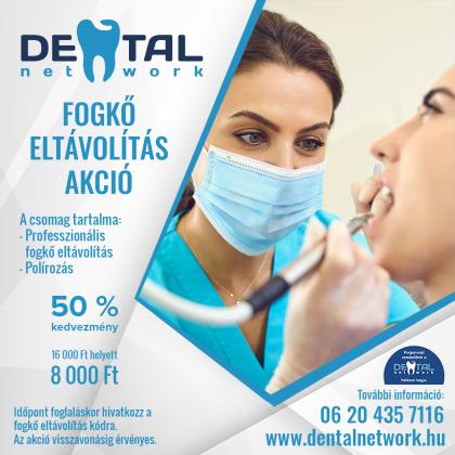 Fogkő Eltávolítás Akció az Árkád Dentalban Fogkő Eltávolítás Akció az Árkád Dentalban