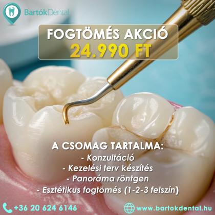 Fogtömés Akció Fogtömés Akció