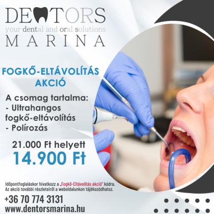 Fogkő Eltávolítás AKCIÓ Fogkő Eltávolítás AKCIÓ