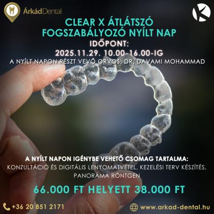 Clear X Nyílt Nap Clear X Nyílt Nap