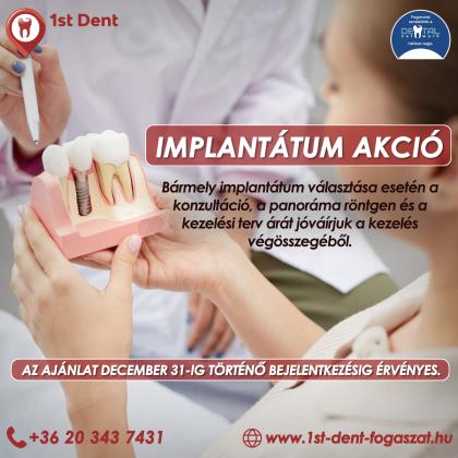 Implantátum Akció