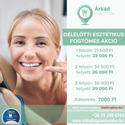 Délelőtti Esztétikus Fogtömés AKCIÓ
