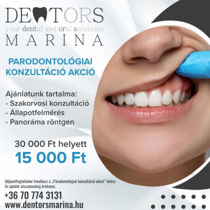 Parodontológiai konzultáció akció